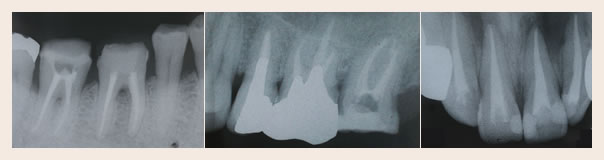 ���ÏI����̃����g�Q���ʐ^